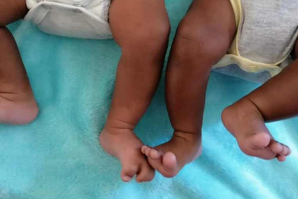 Baby Hope House baby feet